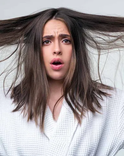 Alopecia. La caída del cabello
